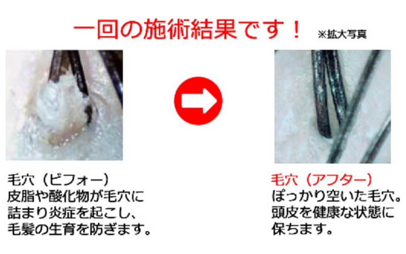 おすすめ無添加シャンプーとビーワンで
