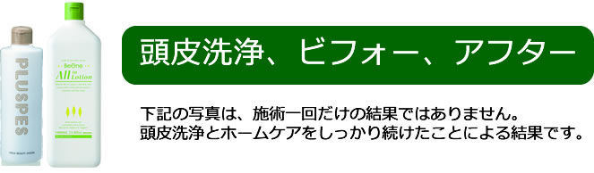 おすすめ無添加シャンプーが大事なわけ