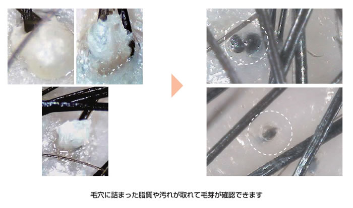 無添加シャンプーとビーワンの大事さ