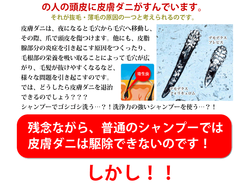 抜け毛予防におすすめできるオーセル藻SOU無添加シャンプーです。
